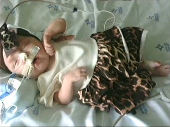 Com doença rara, bebê de 6 meses já teve mais de 200 paradas cardíacas