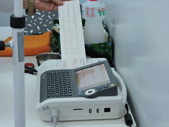 Pacientes da ESF não precisarão mais ir até 

Santa Rosa para realização de exame