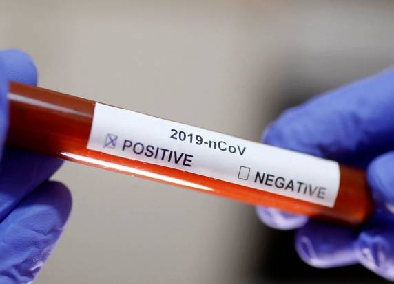 Pessoas tiveram contato direto com o paciente do primeiro caso registrado em São Luiz Gonzaga