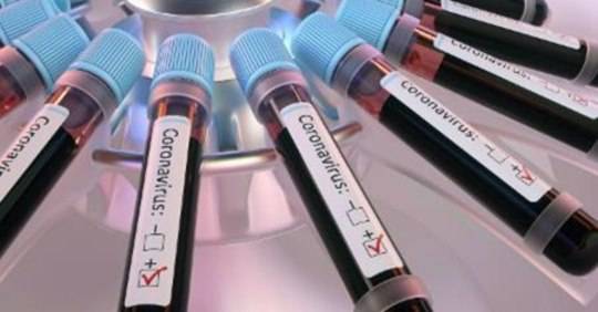 Paciente que veio a óbito na quinta-feira (14) teve o exame confirmado pelo laboratório na tarde de ontem. Casal do interior testa positivo ao Coronavírus