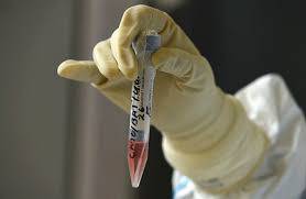 Mortes pela covid-19 somam 28.463 na região