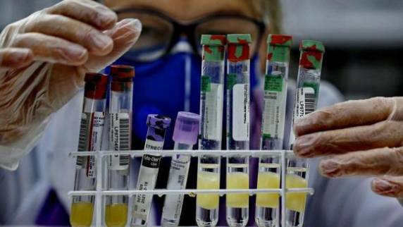 Estado confirmou mais 19 mortes por covid-19 neste domingo