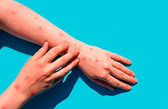 Paciente esteve recentemente em Altamira, no Pará