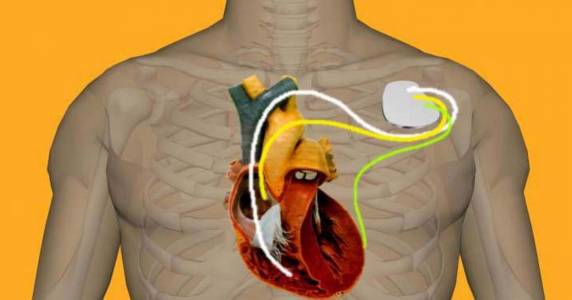 Portaria publicada pelo Ministério da Saúde também afeta outros procedimentos, medicamentos, órteses, próteses e materiais especiais. Redução é em até 50% dos valores