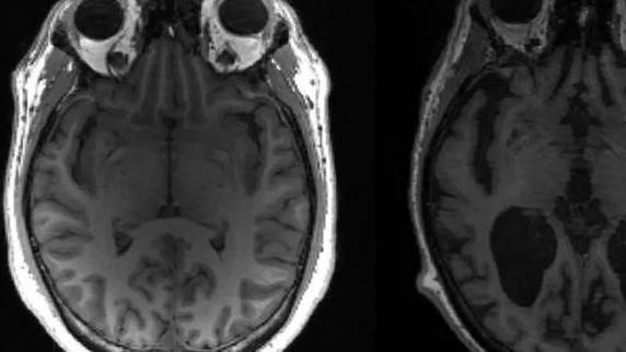 Resultados de pesquisa foram descritos como 